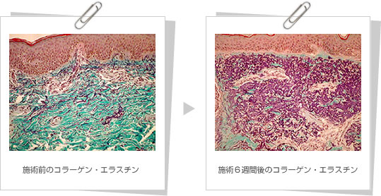 コラーゲン,エラスチンを増加させます。 コラーゲン,エラスチンを増加させます。
